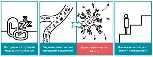 Пошаговое описание процедуры УБОД